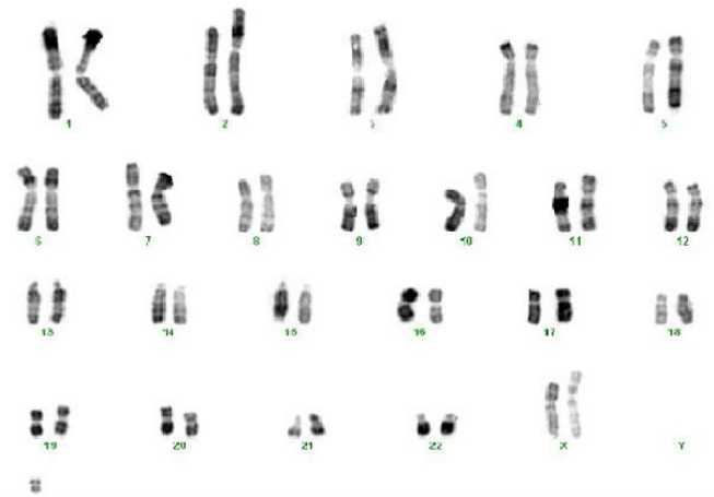 Chromosomes