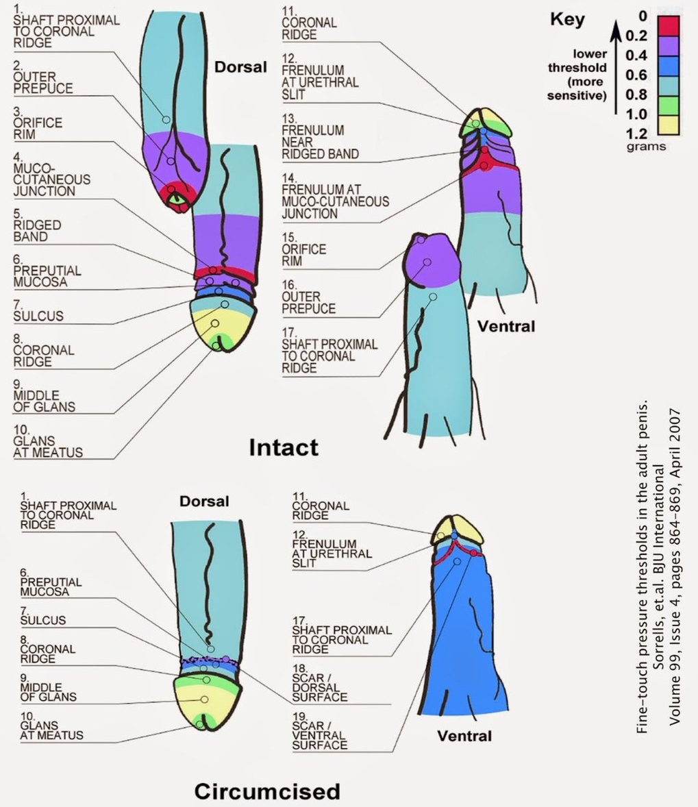 Sensibility of circumcised vs whole penis